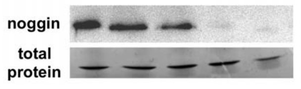 Noggin protein secreted in the conditioned medium (CM).jpg